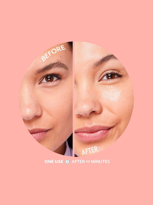 Serve Chilled Bubbly Brightening Hydrogel Mask